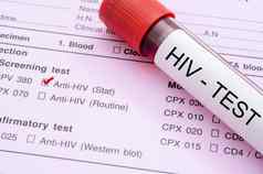 样本血集合管艾滋病毒测试标签