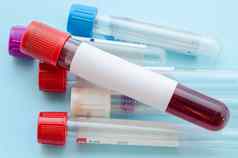 血样本测试空管血血测试