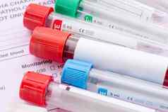 血样本测试空管血血测试筛选