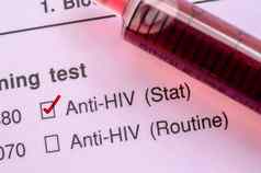 红色的正确的检查马克血样本艾滋病毒测试