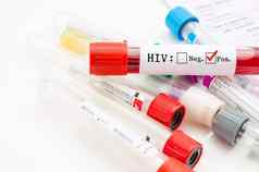 样本血集合管艾滋病毒测试