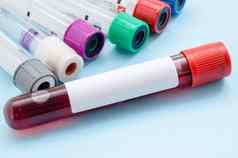 血样品管筛选测试