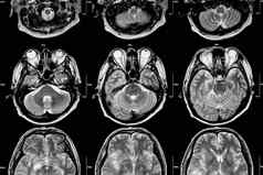 核磁共振大脑交叉部分大脑医疗健康护理科学背景