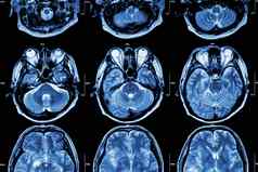 核磁共振大脑交叉部分大脑医疗健康护理科学背景