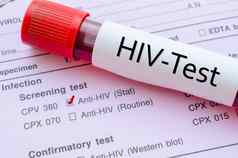 艾滋病毒感染筛选测试形式