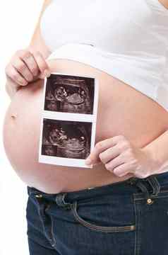 怀孕了女人显示超声波图片婴儿