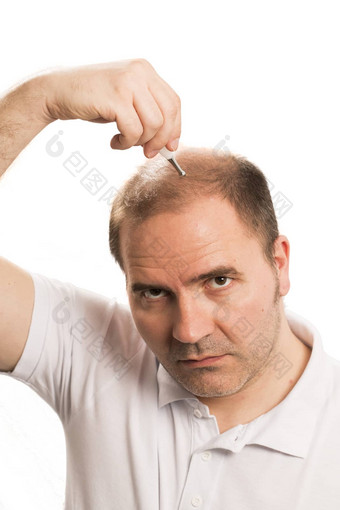 秃顶<strong>脱发</strong>男人。头发损失孤立的
