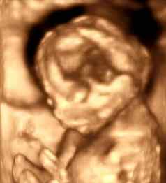超声分析月胎儿