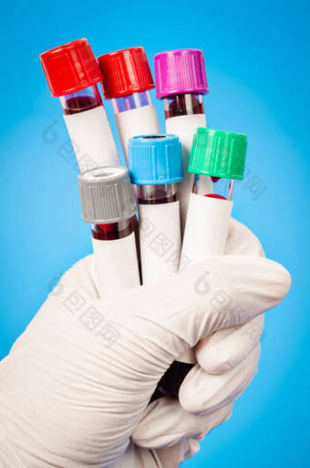 真空管收集血样品实验室