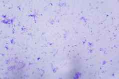 神经细胞显微镜摘要蓝色的点白色