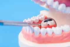 牙牙科龋齿假牙设备