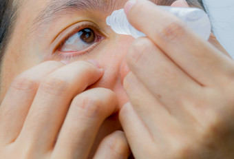 成人亚洲女人应用眼睛滴棕色（的）眼睛眼睛护理概念