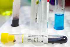 葡萄球菌细菌血测试管样品实验室化学液体元素收拾残局