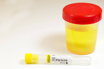 药物测试医疗尿液尿尿测试血管白色背景色彩斑斓的实验室测试容器