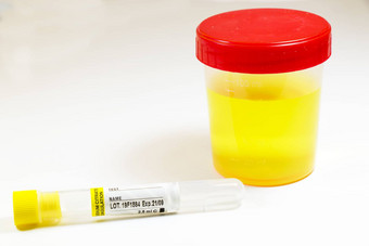 药物测试医疗尿液尿尿测试血管白色背景色彩斑斓的实验室测试容器