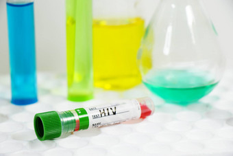 艾滋病毒血测试管样本艾滋病免疫病毒