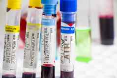 科维德肝炎肺结核葡萄球菌病毒血测试管实验室诊断