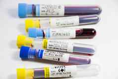 科维德肝炎肺结核葡萄球菌病毒血测试管实验室诊断