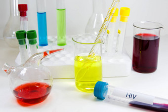 <strong>艾滋病</strong>毒<strong>艾滋病</strong>感染血测试样本诊断实验室化学液体元素