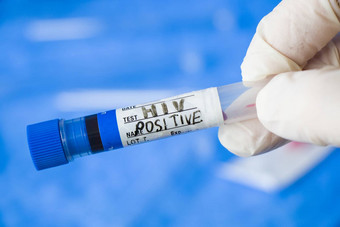 艾滋病毒艾滋病感染测试手持有管血蓝色的背景
