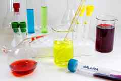 疟疾血测试管样品实验室诊断化学元素仪器