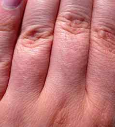 手指皮肤