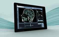 数字平板电脑显示大脑接口
