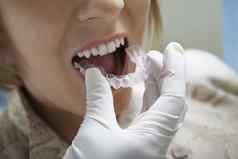 特写镜头牙医的手放置塑料牙套