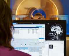 扫描仪大脑核磁共振x射线医院
