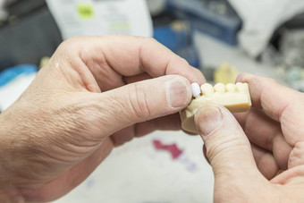 牙科技术员工作印刷模具牙植入物