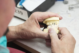牙科技术员工作印刷模具牙植入物