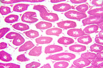 显微镜摄影睾丸精小管交叉教派
