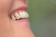 女人牙齿防止牙周病