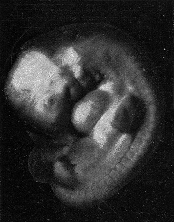 人类胚胎古董雕刻