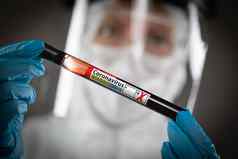 女实验室工人持有测试管血标签冠状病毒科维德疾病