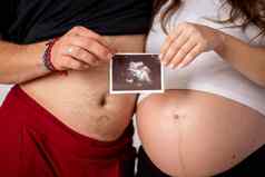 快乐结婚了夫妇显示怀孕测试坚持超声波图片未出生的婴儿焦点条纹