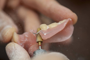 牙科技术员使牙科圣餐台牙科实验室