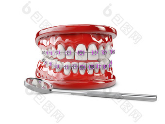 牙齿括号牙科护理概念插图