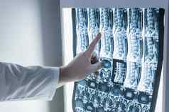 神经学家外科医生检查病人的脊柱图像