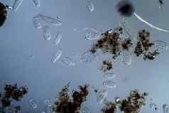 浮游生物微观纤毛虫