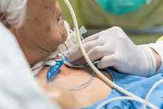 病人气管造口术呼吸机医院