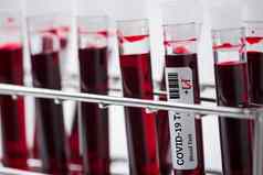 血样本测试管实验室架血样本