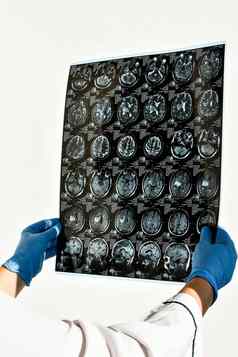 医生保护手套持有大脑核磁共振医疗办公室核磁共振扫描人类头诊所