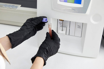 女研究科学家把测试管血样本分析仪医疗机科学家作品现代医疗设备实验室