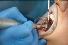 牙医牙科治疗女病人牙医检查病人的牙齿现代牙科办公室