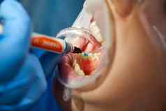 牙医牙科治疗女病人牙医检查病人的牙齿现代牙科办公室