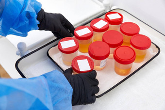 尿液分析实验室医疗尿液测试尿液样本实验室分析