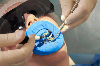 病人牙科治疗牙医办公室牙科橡胶大坝保护
