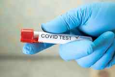 积极的血感染样本测试管科维德冠状病毒实验室科学家持有检查分析病人医院