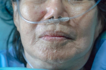 上了年纪的女人鼻呼吸管呼吸
